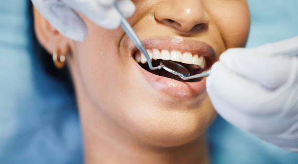 Best Emergency Dentist for Knocked-Out Tooth in Live Oak, CA