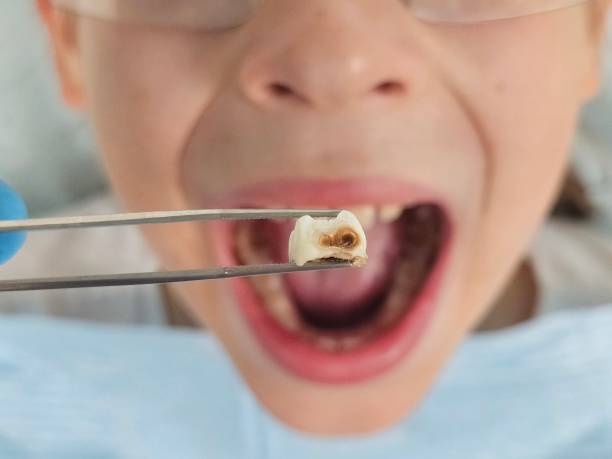 Best Pediatric Emergency Dentist in Live Oak, CA